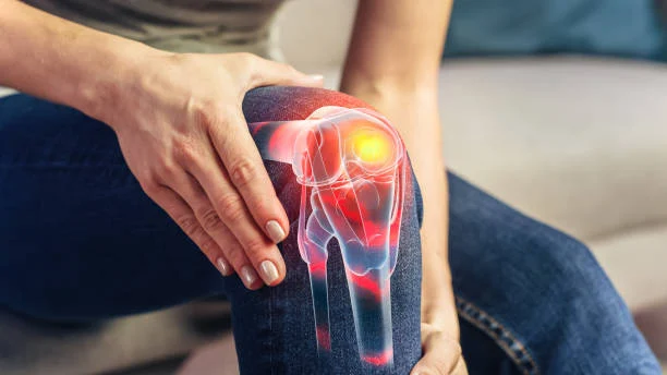 Knee Joint Osteoarthritis and Cartilage Degeneration