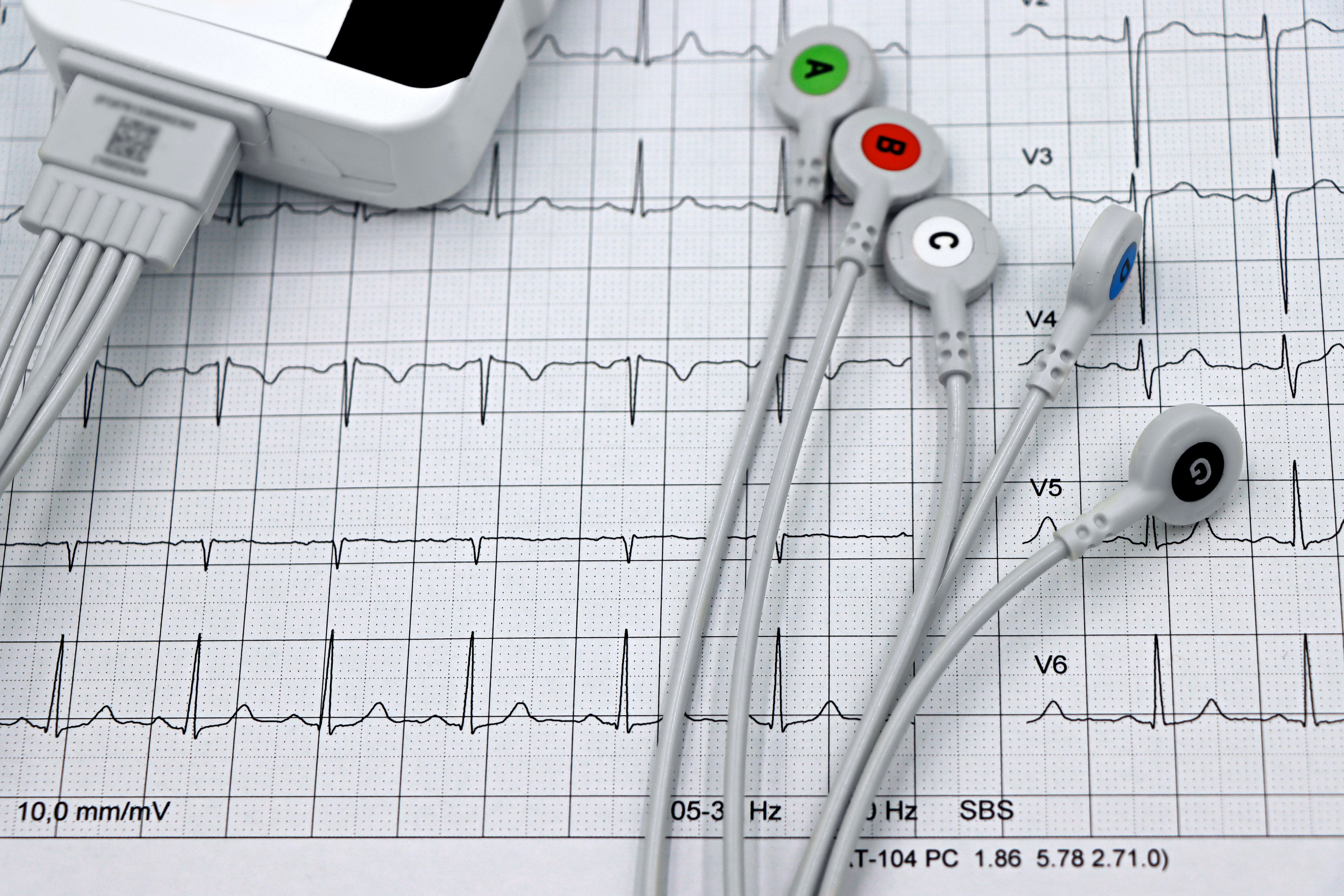 Preoperative cardiac evaluation with ECG monitoring for patients undergoing knee replacement