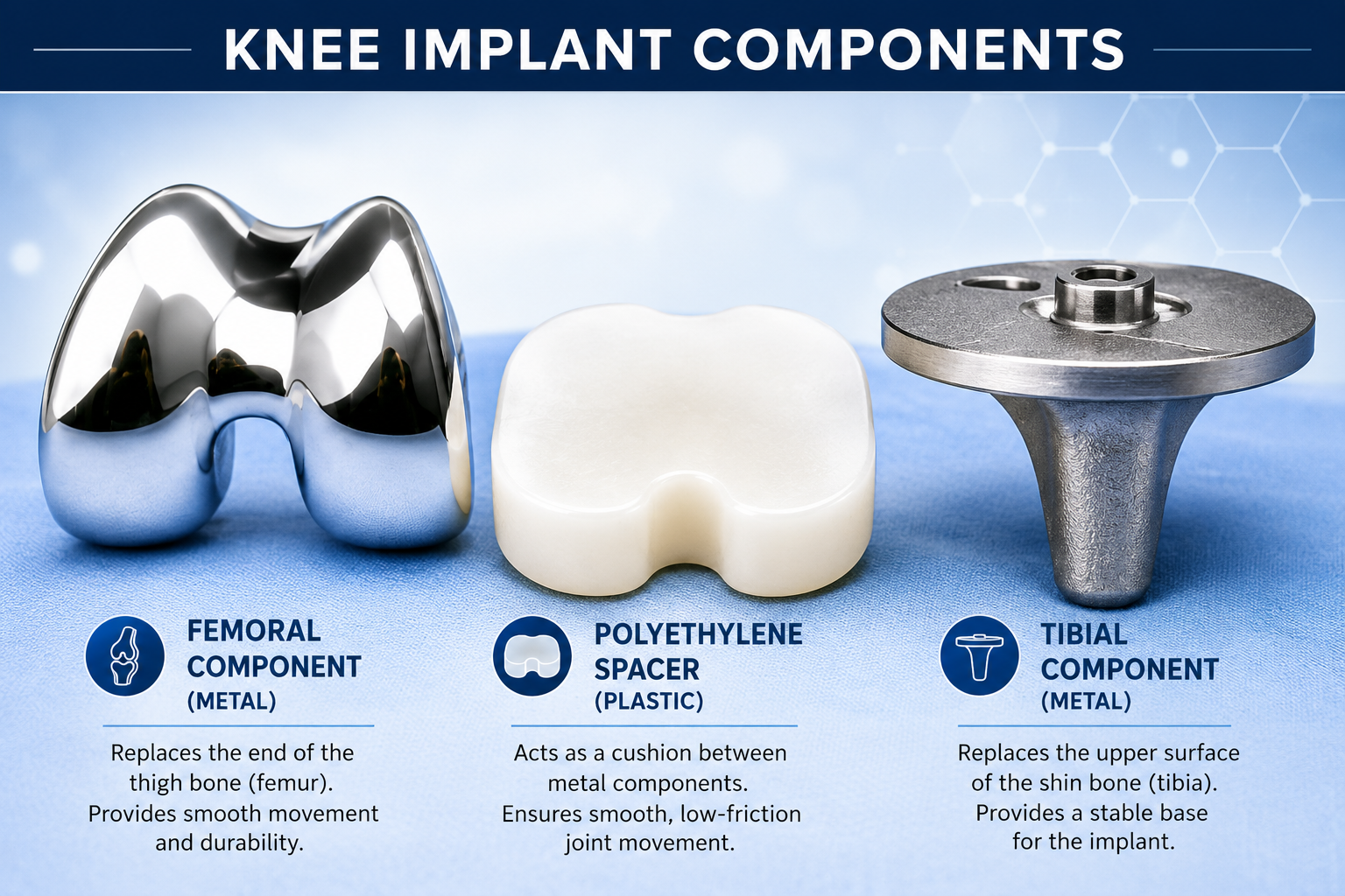 Common reasons knee implants wear out