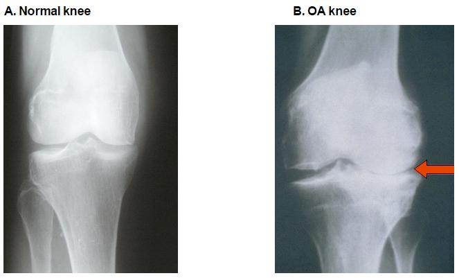 Doctor examining a patient's knee