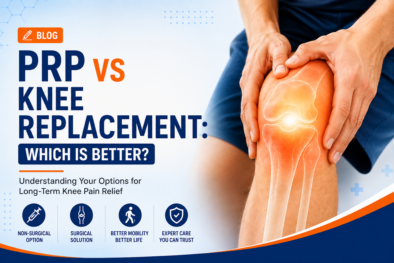 PRP vs Knee Replacement: Which Is Better?