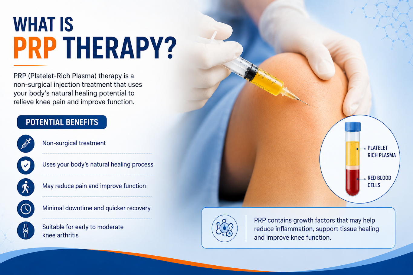 Knee replacement surgery for advanced knee arthritis